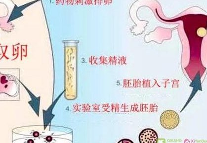 试管婴儿费用明细如何？不同情况差距最大