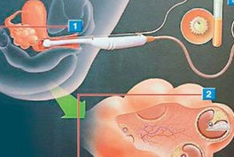 泰国试管婴儿的条件有哪些？哪些指标可以评估生育能力